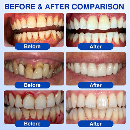 👨‍⚕️🦷🛡️SEAGRIL ® Gum health Periodontal Repair Gel