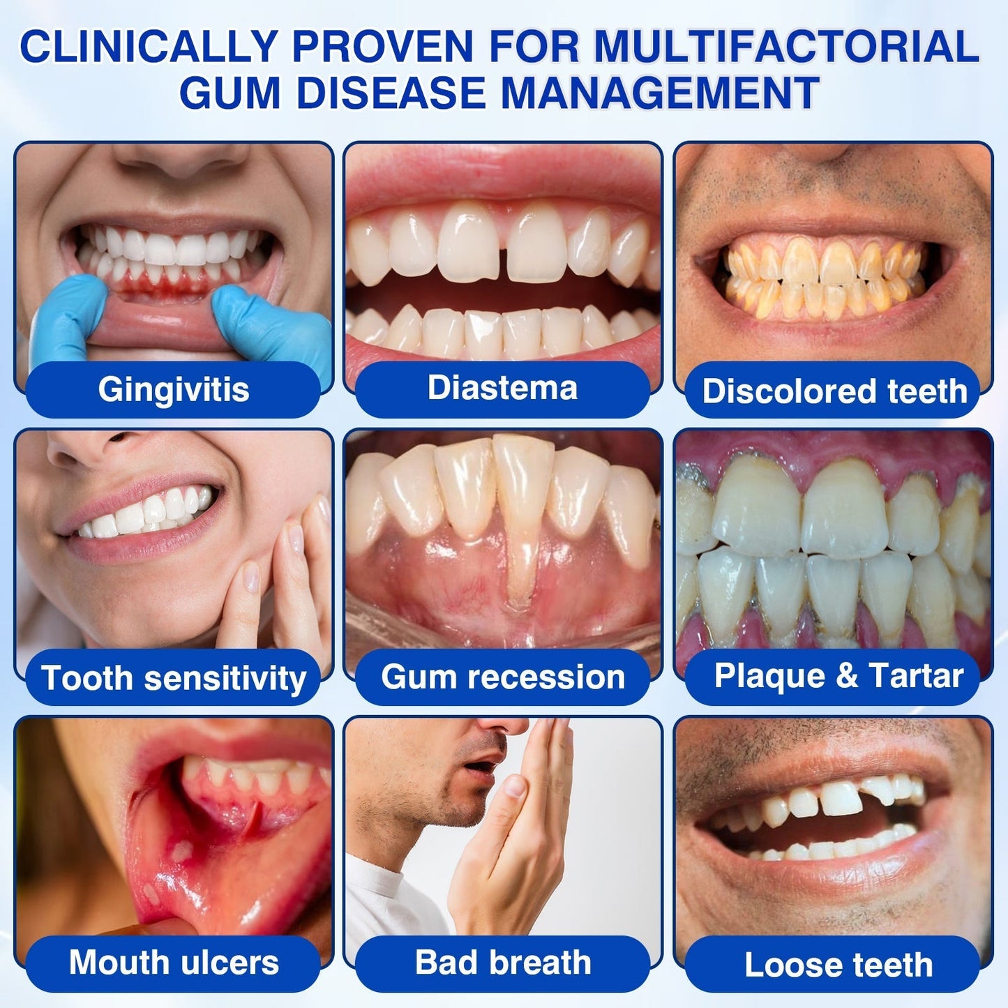 👨‍⚕️🦷🛡️SEAGRIL ® Gum health Periodontal Repair Gel