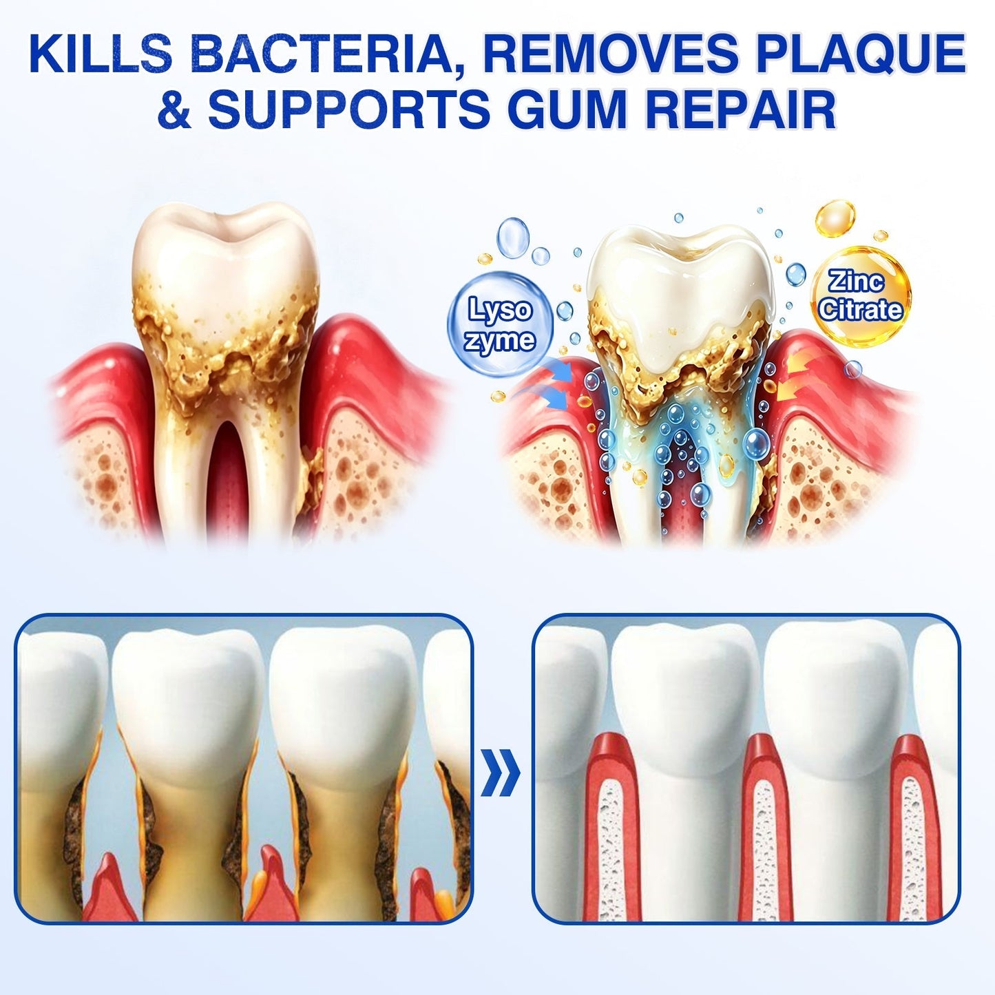 👨‍⚕️🦷🛡️SEAGRIL ® Gum health Periodontal Repair Gel